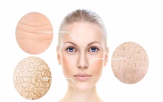 Vào mùa khô hanh, khả năng tự tiết ra những chất hữu cơ tự nhiên cùng mồ hôi giúp da nhờn, đàn hồi và chống lại sự xâm nhập của các loại vi khuẩn của làn da giảm đi, khiến da bị khô và nứt nẻ, gây ngứa.