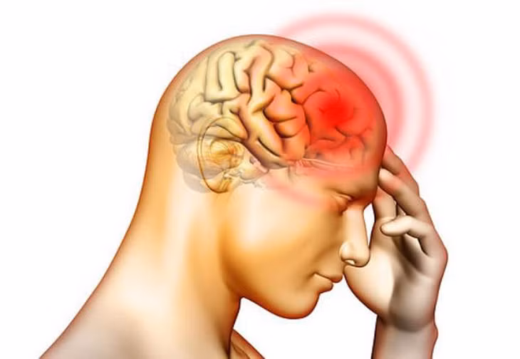 Đau nửa đầu có thể kéo dài, tái phát liên tục, người bệnh cần khám để chữa trị, kiểm soát bệnh hiệu quả - Ảnh minh họa