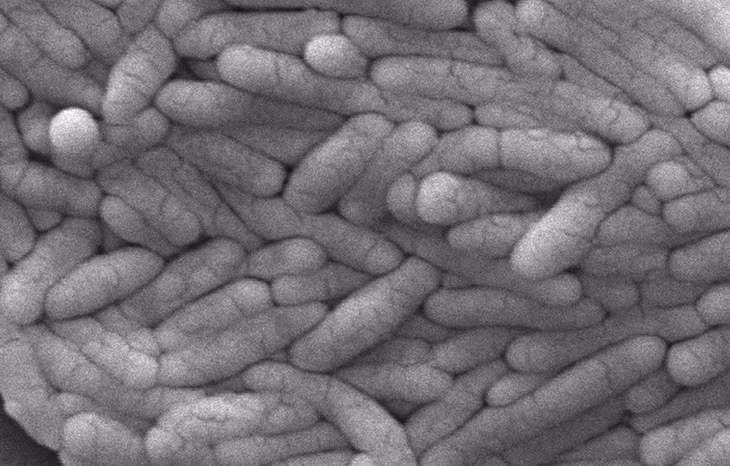 Vi khuẩn salmonella. Ảnh: CDC