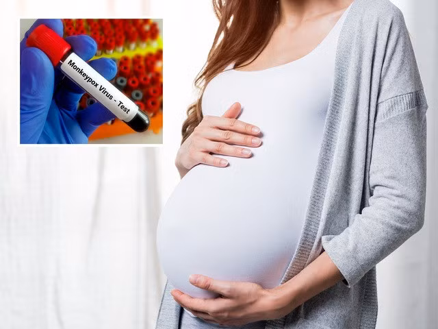Nghiên cứu vẫn đang tiếp tục về tác động của bệnh đậu mùa khỉ đối với phụ nữ mang thai. ISTOCK