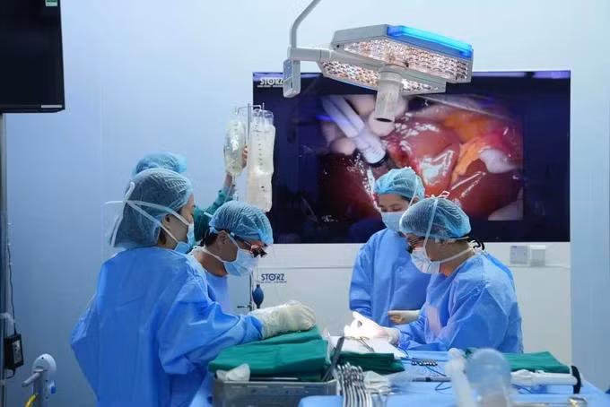 Các bác sĩ đang thực hiện ca ghép gan