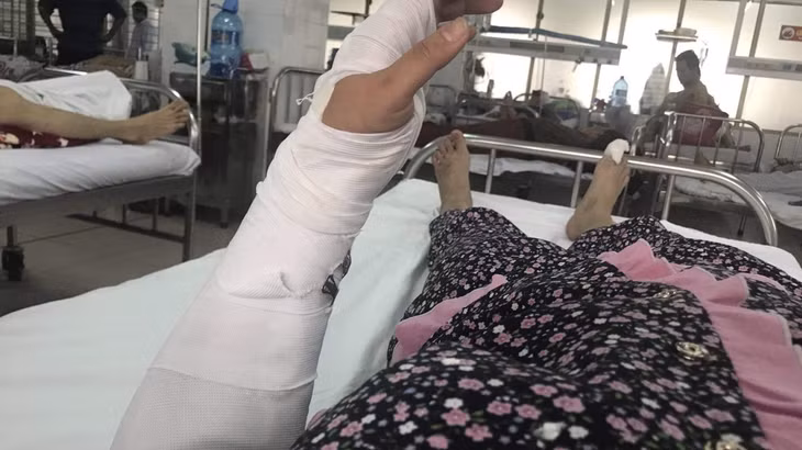 Chị P bị gãy kín xương trụ tay trái, đa chấn thương. Ảnh: Nạn nhân cung cấp