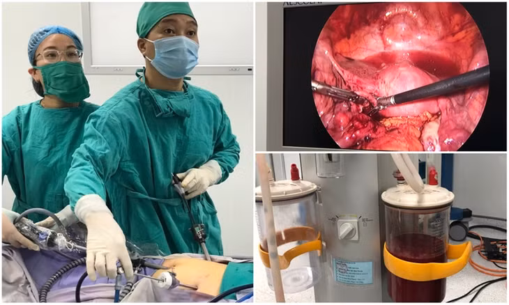 Các bác sĩ TTYT huyện Cô Tô phẫu thuật cấp cứu thành công bệnh nhân bị mất máu do chửa ngoài tử cung vỡ.