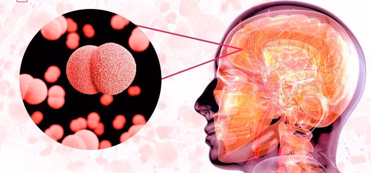 Biểu hiện của viêm não virus khá đa dạng và thường khởi phát cấp tính