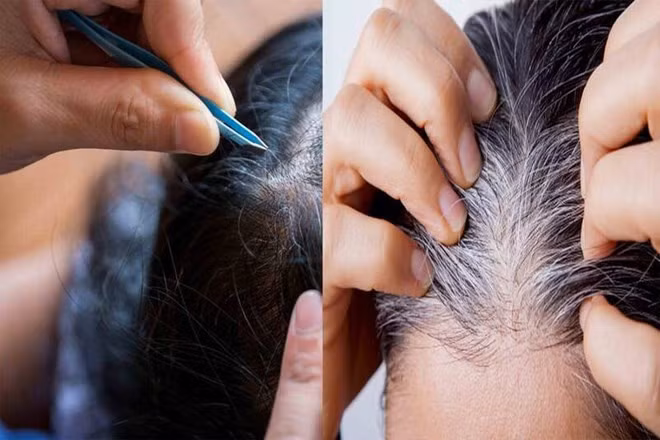 Nhổ tóc bạc thường xuyên sẽ ảnh hưởng đến mái tóc. Đồ hoạ: Hạ Mây