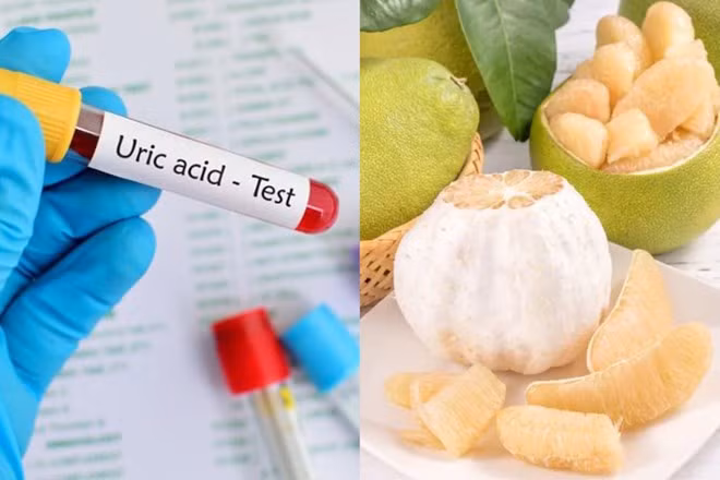 Thêm bưởi vào chế độ ăn có thể làm giảm nồng độ axit uric, ngăn ngừa nguy cơ mắc bệnh gout. Đồ hoạ: Phương Anh
