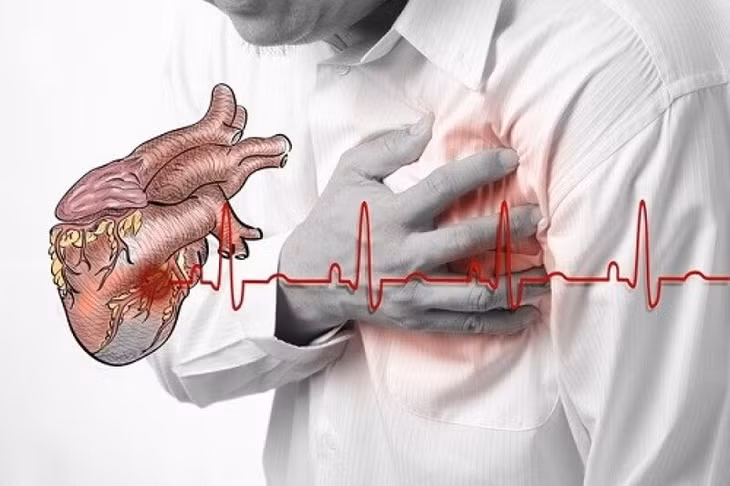 Nhồi máu cơ tim có thể xảy ra bất ngờ, nhưng có những trường hợp được cảnh báo trước hàng giờ