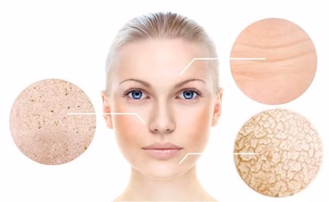 Nếu không biết cách chăm sóc da mùa hanh khô, da sẽ trở nên sần sùi, nứt nẻ...