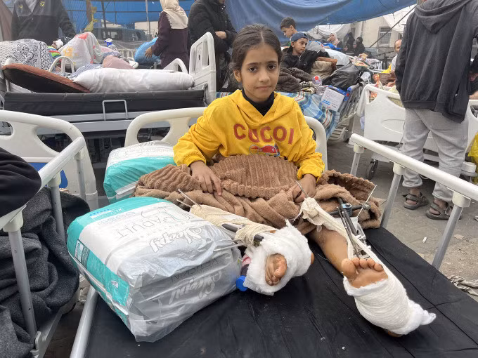Một bé gái bị thương nằm ở khu vực ngoài trời của bệnh viện Al-Shifa, Gaza City, ngày 25/11. Ảnh: AFP