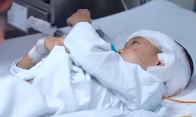 Bé trai đang điều trị tại Bệnh viện Việt Đức. Ảnh: Bệnh viện cung cấp