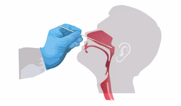 Nhiễm COVID-19, sao có người bị nặng, người nhẹ? - Ảnh 2.