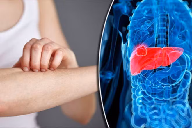 5 dấu hiệu cảnh báo ung thư sớm bạn không nên bỏ qua ảnh 2