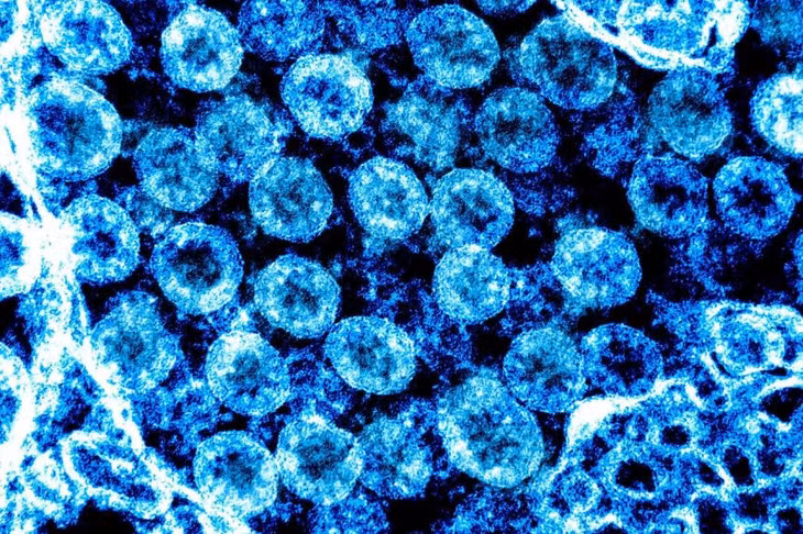 Axit ribonucleic của virus SARS-CoV-2 có thể biến đổi hình dạng khi ở bên trong các tế bào bị nhiễm bệnh. Ảnh: AFP