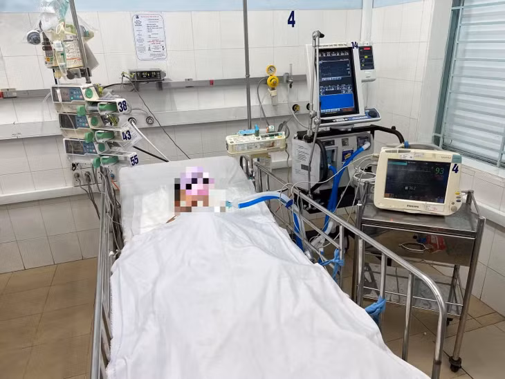 Bé trai 5 tuổi đang được hỗ trợ thở máy. Ảnh: BV