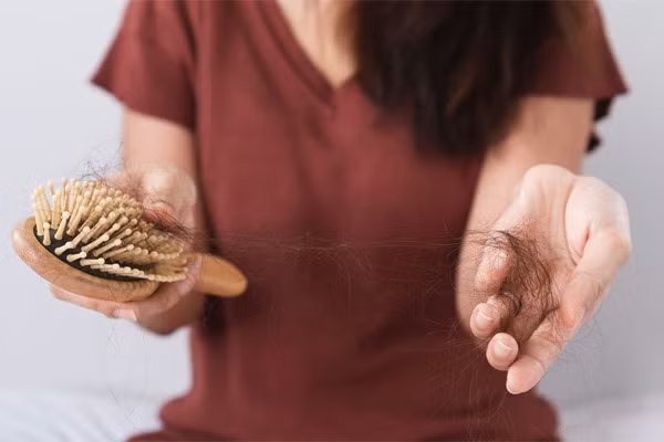 Lý do người từng nhiễm Covid-19 bị rụng tóc nhiều không tưởng