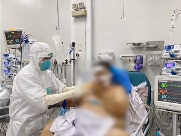 Nganh Y te chuan bi san sang cap cuu, dieu tri ca benh COVID-19 nang hinh anh 1