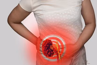 Người bệnh thận mạn cần tuân thủ nghiêm các biện pháp phòng dịch để ngăn ngừa nguy cơ lây nhiễm.