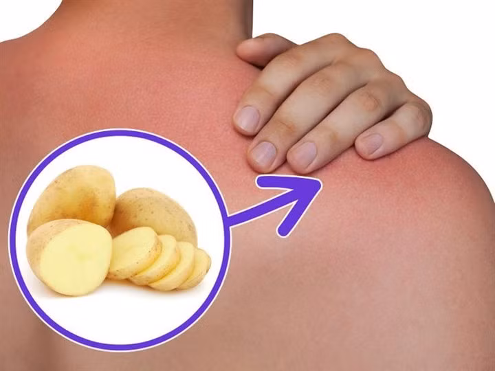 9 công dụng thần kỳ của khoai tây ảnh 2