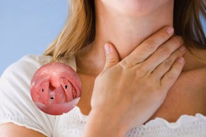 Ung thư vòm họng: Dấu hiệu nhận biết và cách tầm soát ảnh 1