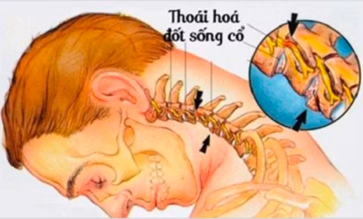 (Ảnh minh họa)