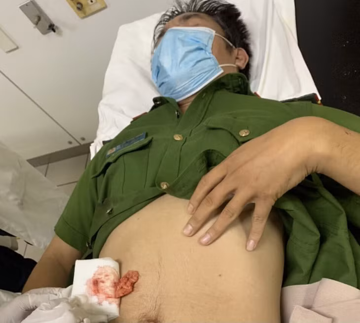 Đại úy Chung bị côn đồ đâm trọng thương.