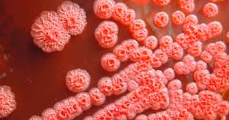 Bệnh Whitmore (còn gọi là Melioidosis) là bệnh truyền nhiễm do vi khuẩn Burkholderia pseudomallei gây ra. Vi khuẩn này tồn tại tự nhiên trong đất, bùn và nước bề mặt bị ô nhiễm. Người có thể mắc bệnh khi tiếp xúc với đất, bùn, nước có chứa vi khuẩn qua các vết trầy xước, vết thương hở trên da; do hít phải bụi hoặc giọt nước bị nhiễm khuẩn; hoặc do sử dụng nguồn nước, thực phẩm bị ô nhiễm...