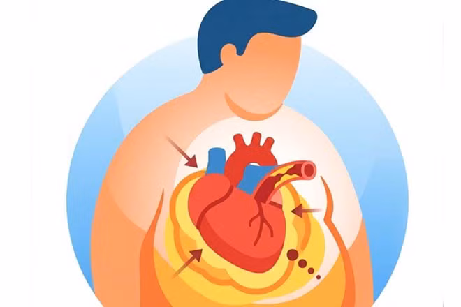 Béo phì có thể âm thầm tàn phá sức khỏe tim mạch ảnh 1