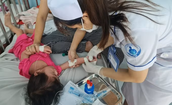 Trẻ mắc bệnh sởi điều trị tại Bệnh viện Nhi đồng 1, ngày 12/8. Ảnh: Lê Phương