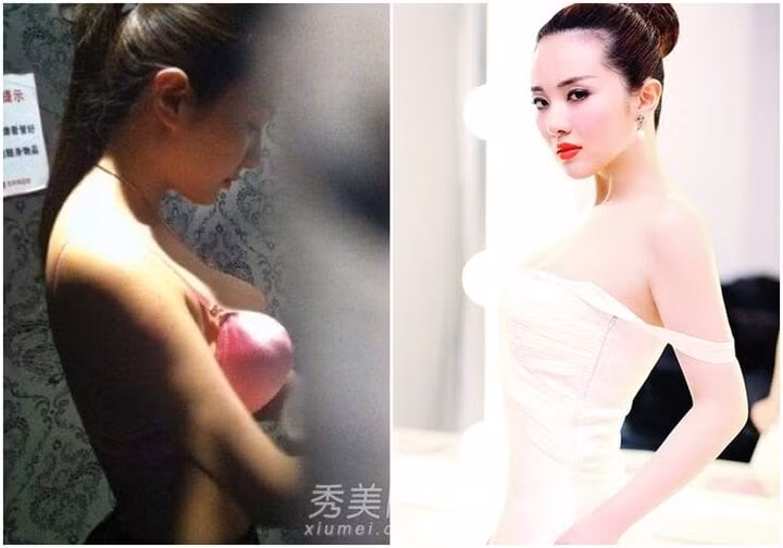 Mạnh Thiến bị cho là tự dàn dựng vụ chụp lén nhằm mục đích nổi tiếng.
