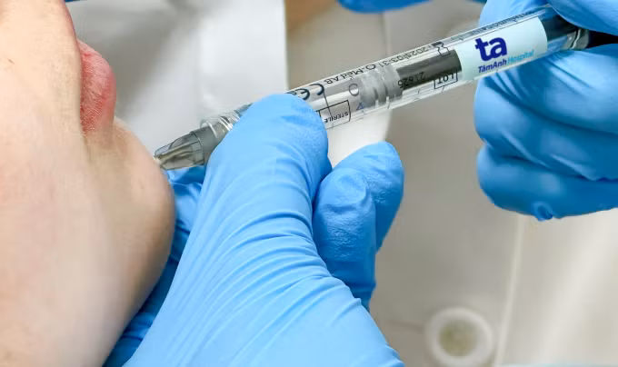 Tiêm filler làm tăng thể tích vùng cằm bị ngắn cho một phụ nữ tại Bệnh viện Đa khoa Tâm Anh TP HCM. Ảnh: Bệnh viện cung cấp