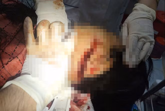 Bà Trần Thị L (huyện Bát Xát, Lào Cai) được đưa vào bệnh viện để cấp cứu trong trạng thái bị thương nặng, chảy máu nhiều. Ảnh: Người dân cung cấp