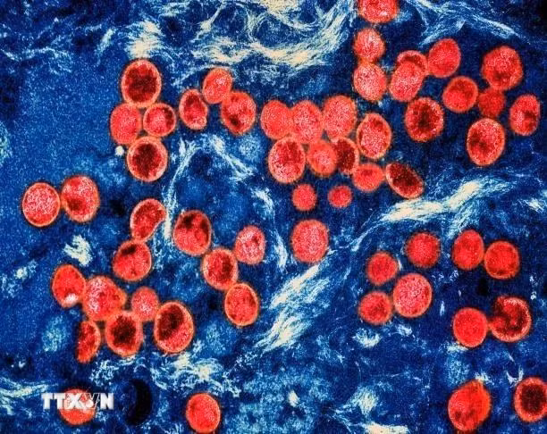 Hình ảnh virus đậu mùa khỉ dưới kính hiển vi. (Ảnh: Getty Images/TTXVN)