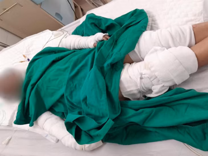 Cả 3 bệnh nhân đang được điều trị tại Bệnh viện Đa khoa tỉnh Kon Tum. Ảnh: Lê Nguyên