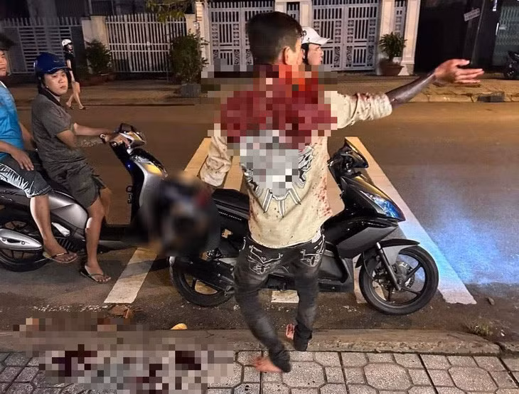 B. bị Ty chém đứt lìa tay ngay ngoài đường - Ảnh: Người dân cung cấp