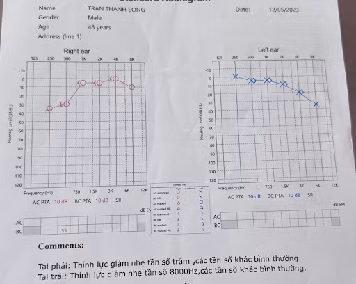 Anh Song đi khám kết quả cho thấy thính lực bị suy giảm