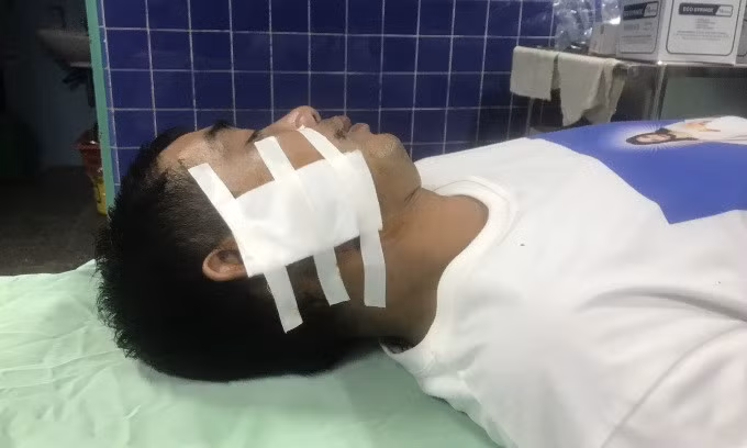 Bệnh nhân đang được điều trị tại bệnh viện. Ảnh: Đào Giang Sơn