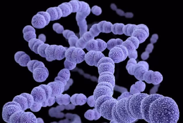 Viêm họng còn do nguyên nhân từ vi khuẩn trong đó hay gặp liên cầu khuẩn (streptococcus