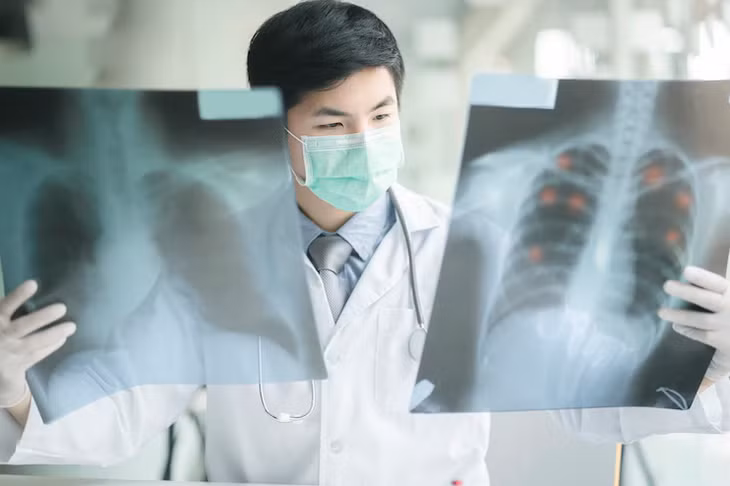 Ung thư phổi di căn não là nguy hiểm nhất. Ảnh: Freepik