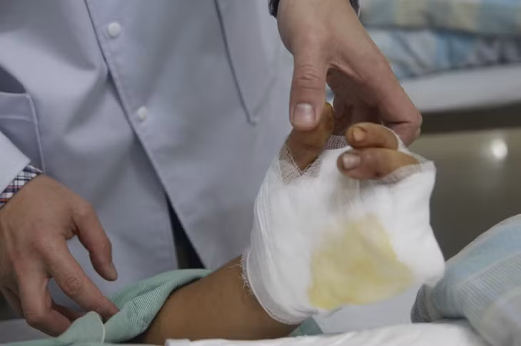 Bệnh nhân chấn thương nghiêm trọng do pháo nổ, điều trị tại Bệnh viện Bãi Cháy, năm 2022. Ảnh: Mạc Thảo (CTV)