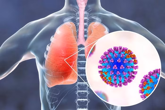 Các virus gây viêm phổi lây truyền giữa người với người thông qua các giọt bắn khi người bệnh ho hoặc hắt hơi.