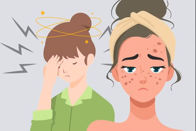 Những dấu hiệu căng thẳng thể hiện trên khuôn mặt. Đồ họa: Thiện Nhân