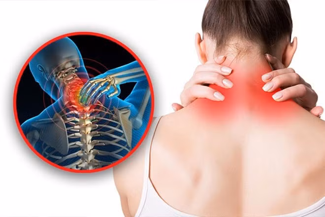 Massage cổ đúng cách không chỉ giúp giảm đau đầu và chóng mặt mà còn giúp thư giãn và cải thiện tuần hoàn máu vùng cổ. Đồ họa: Tuấn Anh