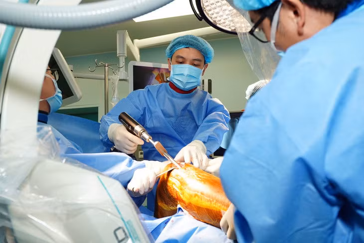 Bác sĩ đã sử dụng kỹ thuật đóng đinh nội tủy kín để đảm bảo không lệch các mảnh gãy - Ảnh: BVCC