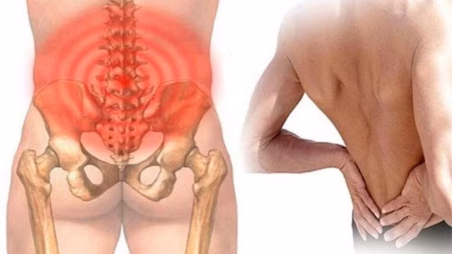 Hầu hết mọi người đều có ít nhất một lần trong đời bị đau cột sống thắt lưng. Có rất nhiều nguyên nhân gây đau cột sống thắt lưng.