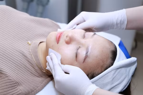 Top 4 địa chỉ peel da, thay da sinh học uy tín ở TPHCM ảnh 4