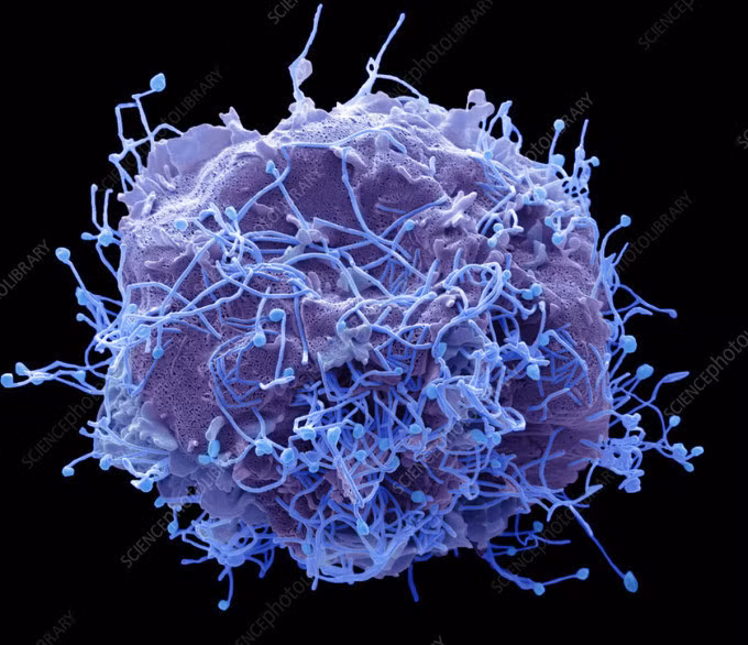 Ảnh hiển vi điện tử của HMPV. Ảnh:Science Photo