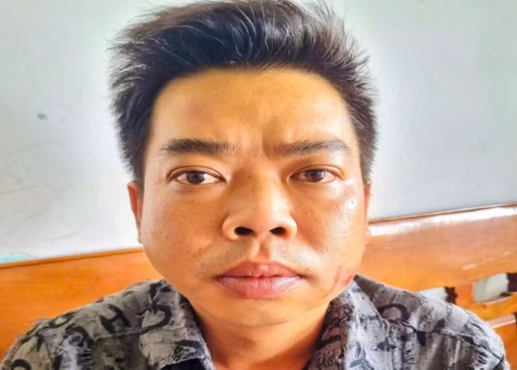 Đối tượng Huỳnh Anh Thuận (30 tuổi) dùng dao tự chế chém K. Ảnh: Gia Bùi