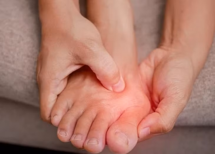 Ngón chân cái thường bị ảnh hưởng nhất bởi gout. Ảnh minh họa: Neufoot.