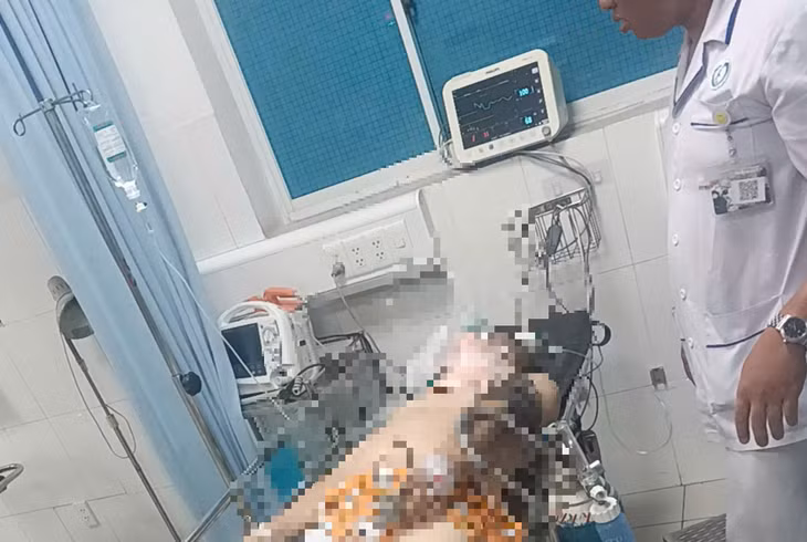 Nạn nhân đang được theo dõi điều trị tại bệnh viện.