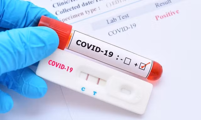 Bộ Y tế đề nghị các địa phương lập đoàn kiểm tra việc sản xuất, kinh doanh test kit xét nghiệm chẩn đoán nhanh và xét nghiệm RT- PCR.
